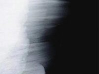 Anybody else but u(beat) - Zy / SORROW